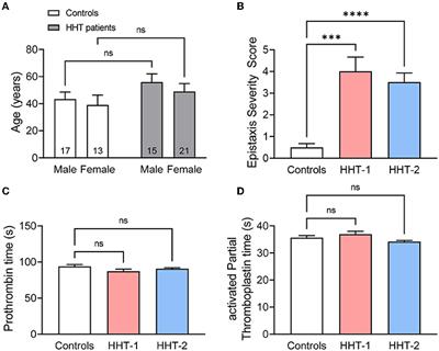 Functional Alterations Involved in Increased Bleeding in Hereditary Hemorrhagic Telangiectasia Mouse Models